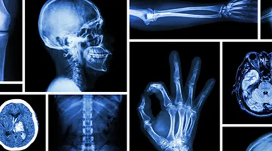 UPDATED South West Nova Facing Radiologist Shortage