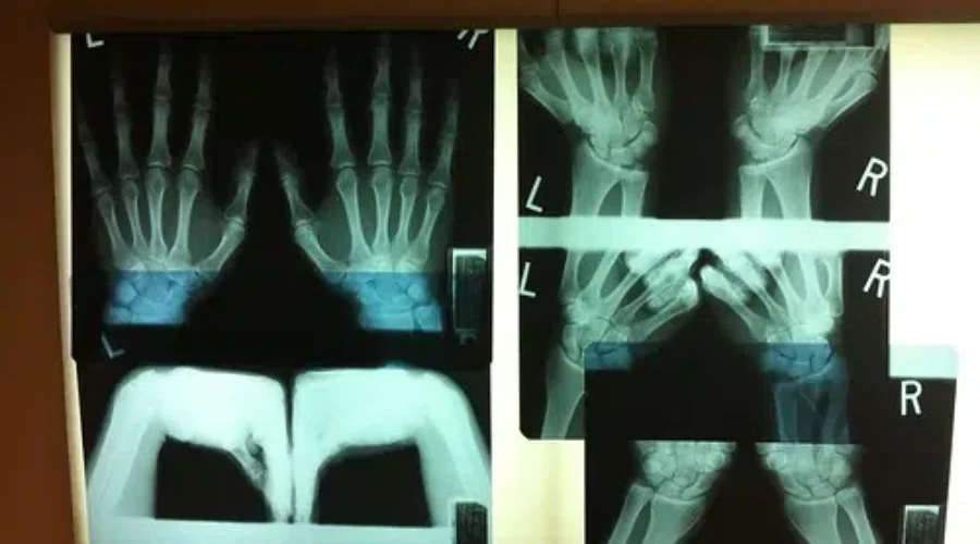 Donations Needed For New X-ray Machine at Roseway Hospital