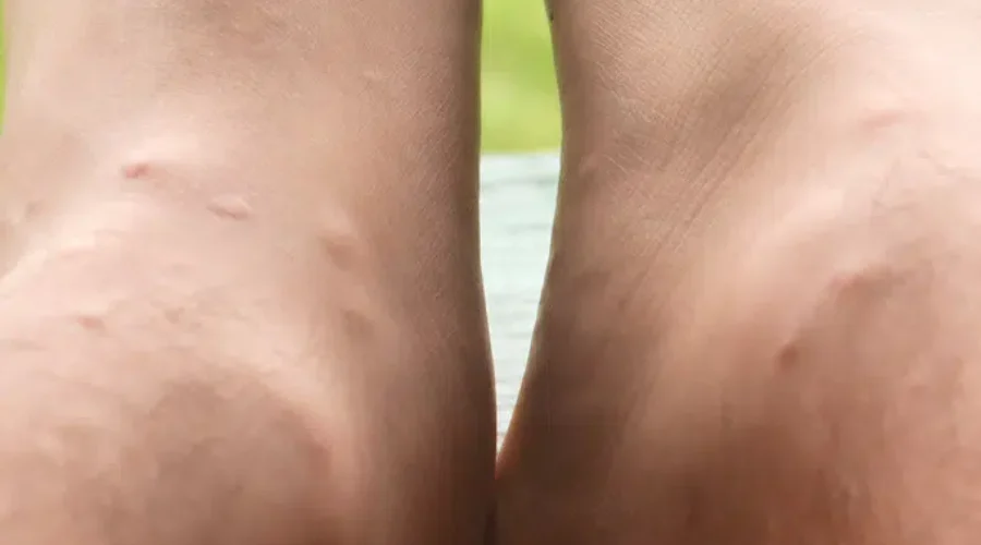 Weekend Weather Great – Black Flies Bad!