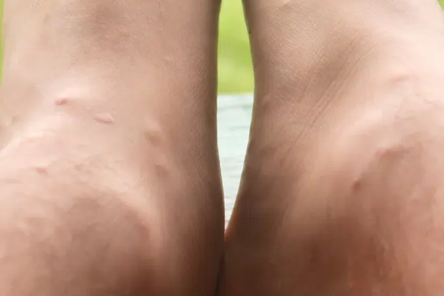 Weekend Weather Great – Black Flies Bad!