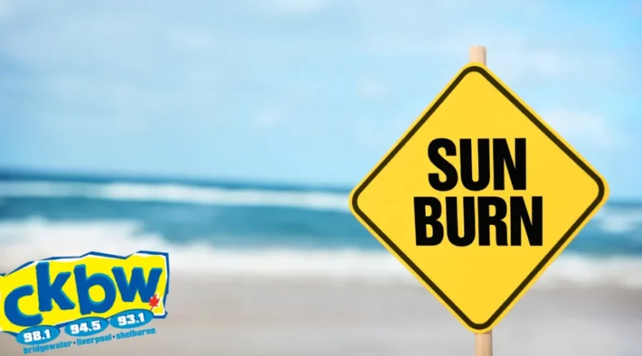 Sunburns! What’s You Remedy?