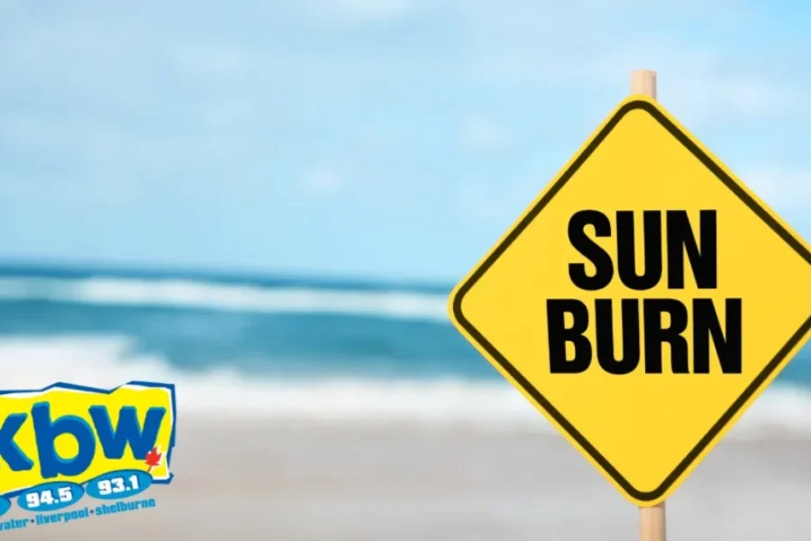 Sunburns! What’s You Remedy?