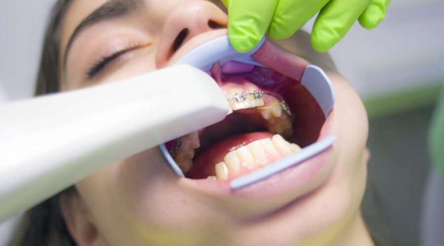 Canada Child Dental Benefit Opens For Applications