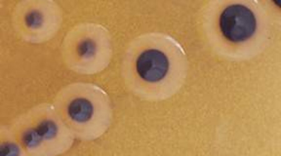 Outbreak of drug-resistant salmonella infections found in Canada: Public Health