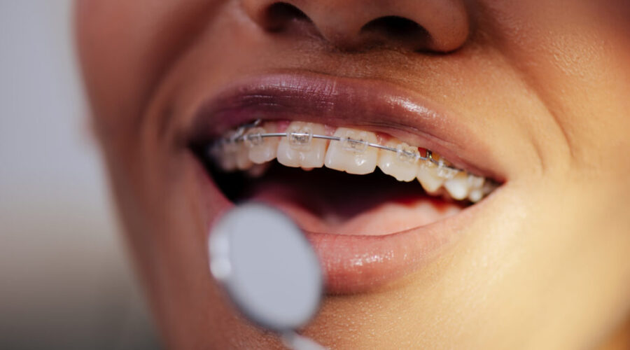 N.S. dental clinics hesitant to enroll in new federal dental plan