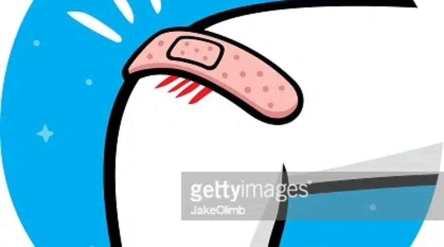 From Ow To WOW – Quick Heal Tips For Weekend BooBoos